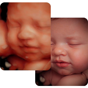 Ultrasonido 3D y 4D en Tampa